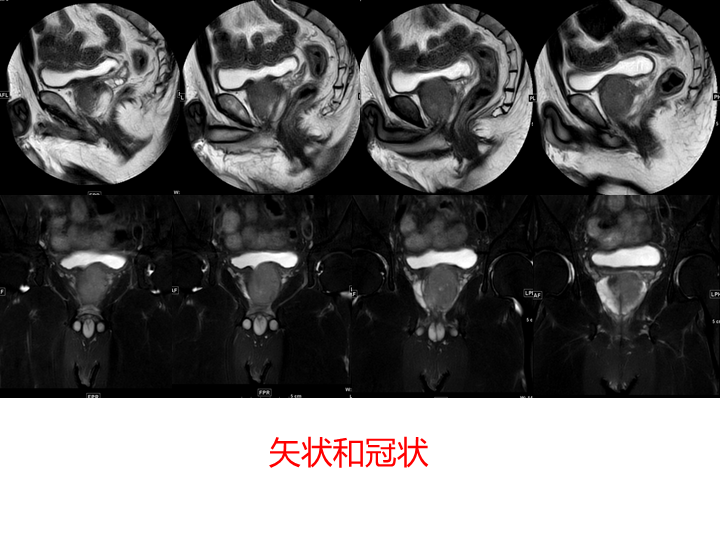 影像PPT - 【PPT】前列腺影像报告和数据系统-7