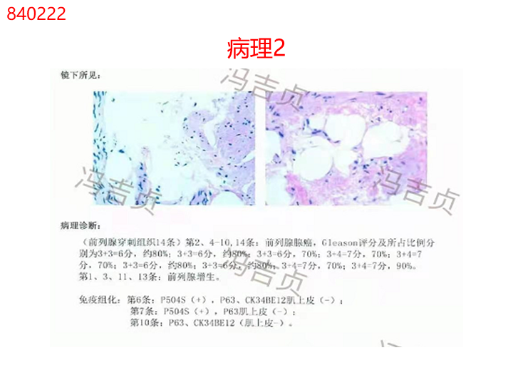 影像PPT - 【PPT】前列腺影像报告和数据系统-23