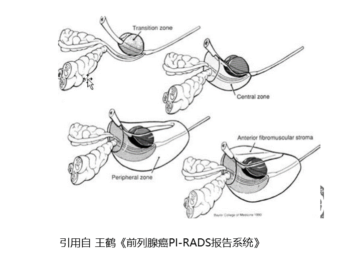 影像PPT - 【PPT】前列腺影像报告和数据系统-27