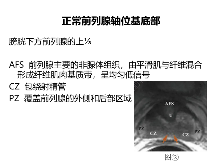 影像PPT - 【PPT】前列腺影像报告和数据系统-29