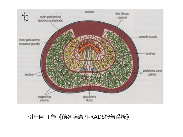 影像PPT - 【PPT】前列腺影像报告和数据系统-26