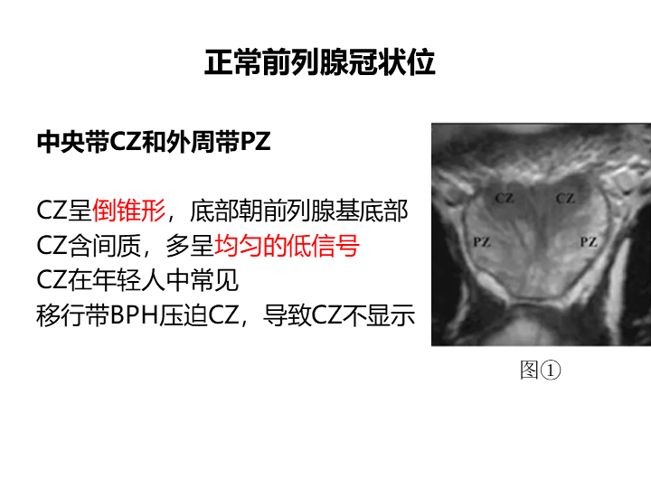 影像PPT - 【PPT】前列腺影像报告和数据系统-28
