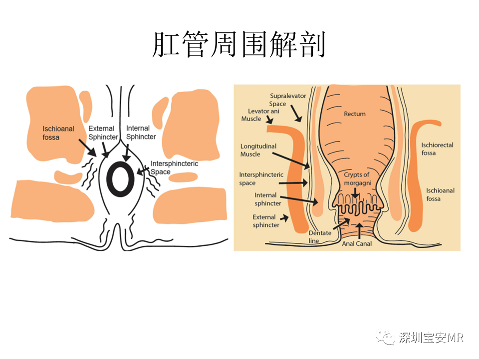 影像PPT - 【PPT】肛瘘MRI诊断-8