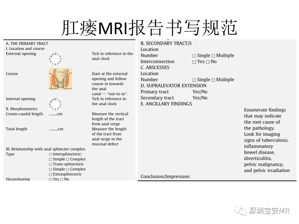 影像PPT - 【PPT】肛瘘MRI诊断-45