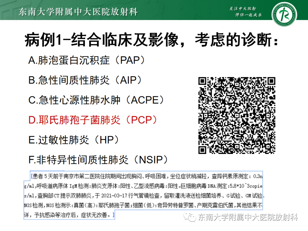 影像PPT - 【PPT】蝶翼征—耶氏肺孢子菌肺炎 VS 急性心源性肺水肿-5 影像PPT - 【PPT】蝶翼征—耶氏肺孢子菌肺炎 VS 急性心源性肺水肿-5