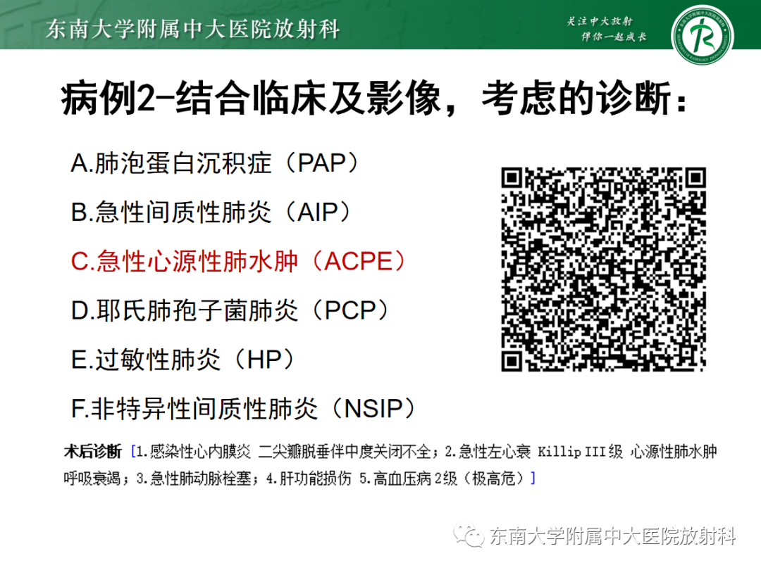影像PPT - 【PPT】蝶翼征—耶氏肺孢子菌肺炎 VS 急性心源性肺水肿-7 影像PPT - 【PPT】蝶翼征—耶氏肺孢子菌肺炎 VS 急性心源性肺水肿-7