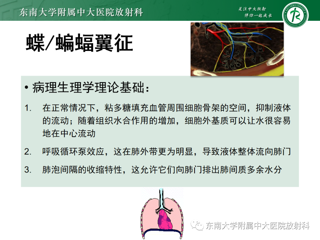 影像PPT - 【PPT】蝶翼征—耶氏肺孢子菌肺炎 VS 急性心源性肺水肿-11 影像PPT - 【PPT】蝶翼征—耶氏肺孢子菌肺炎 VS 急性心源性肺水肿-11