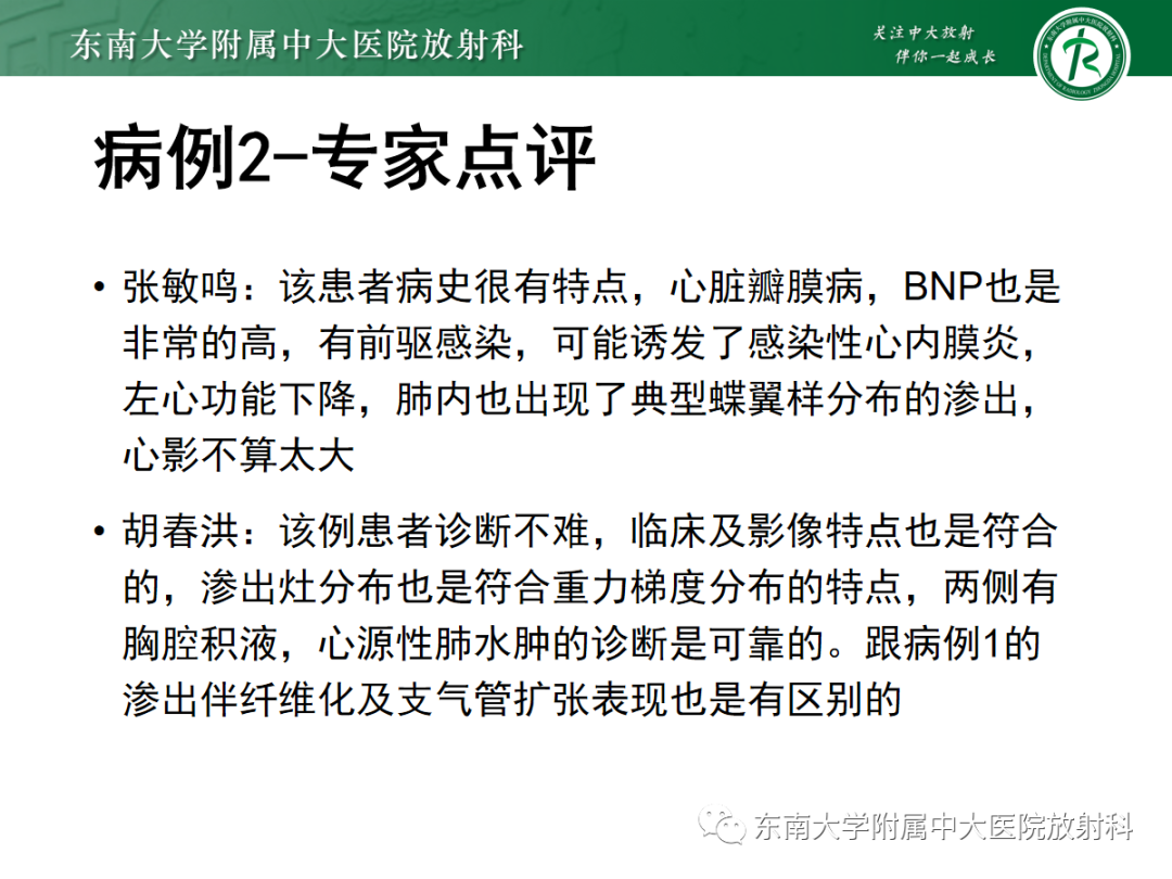 影像PPT - 【PPT】蝶翼征—耶氏肺孢子菌肺炎 VS 急性心源性肺水肿-8 影像PPT - 【PPT】蝶翼征—耶氏肺孢子菌肺炎 VS 急性心源性肺水肿-8