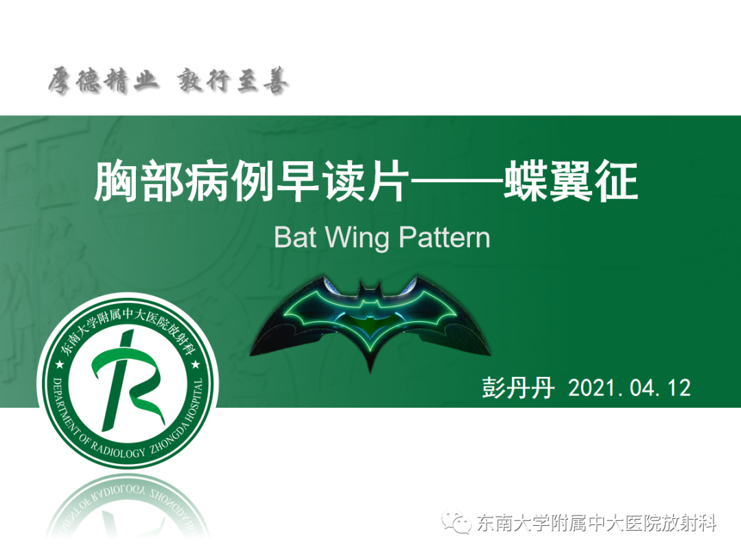 影像PPT - 【PPT】蝶翼征—耶氏肺孢子菌肺炎 VS 急性心源性肺水肿-9 影像PPT - 【PPT】蝶翼征—耶氏肺孢子菌肺炎 VS 急性心源性肺水肿-9