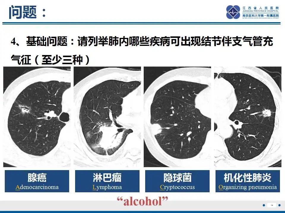 影像PPT - 【PPT】肺淀粉样变性伴粘膜相关淋巴组织淋巴瘤-15