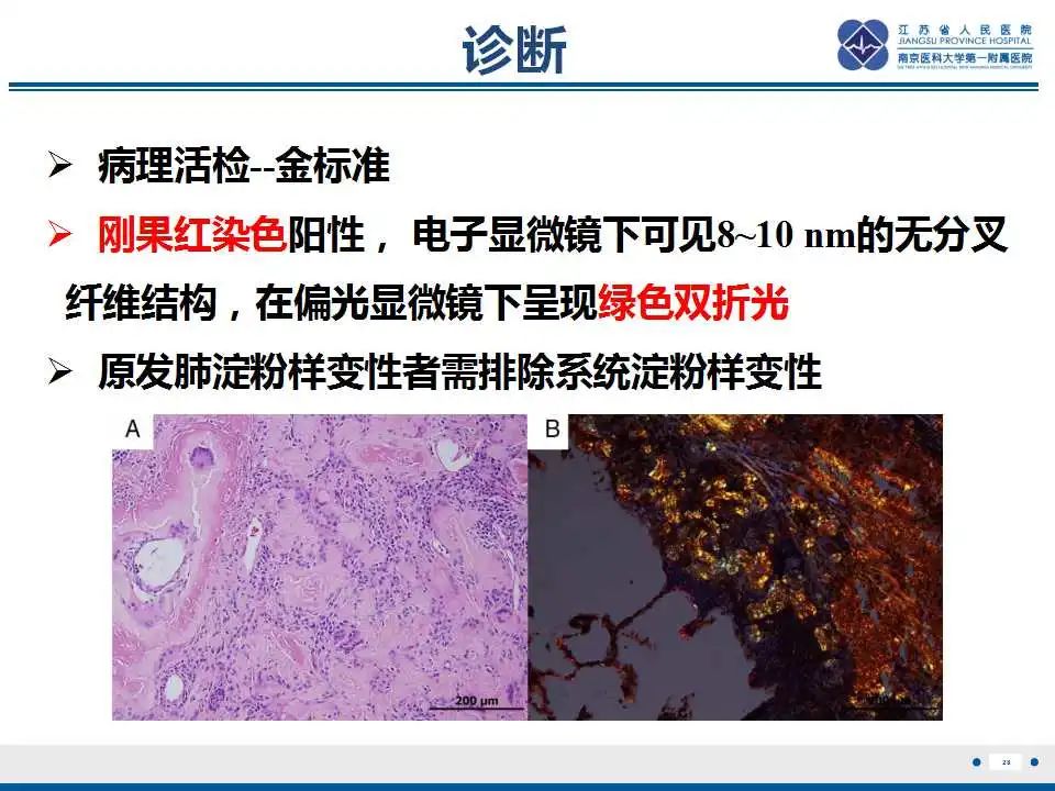 影像PPT - 【PPT】肺淀粉样变性伴粘膜相关淋巴组织淋巴瘤-30