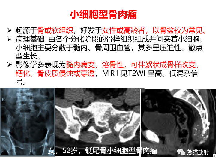 影像PPT - 【病例】骨肉瘤2例X线CT及MR影像-33