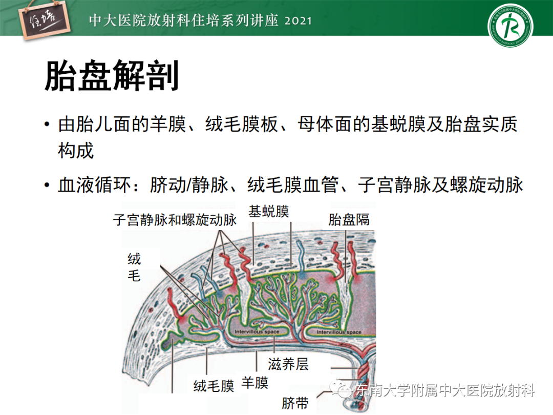 影像PPT - 【PPT】胎盘变异与胎盘植入性疾病的MR评估-4