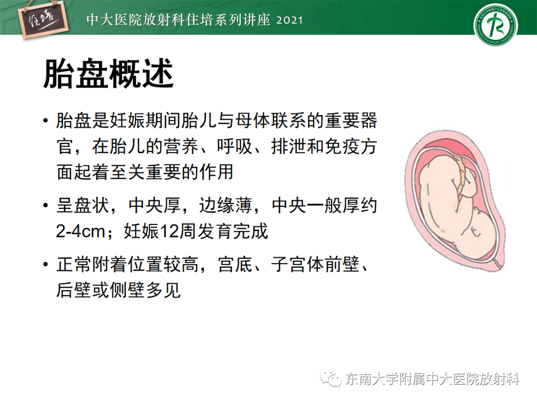 影像PPT - 【PPT】胎盘变异与胎盘植入性疾病的MR评估-3