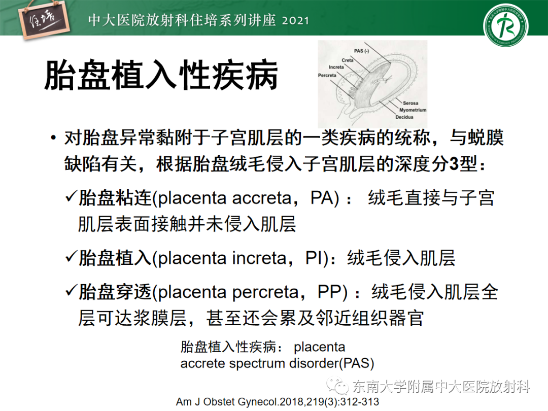 影像PPT - 【PPT】胎盘变异与胎盘植入性疾病的MR评估-15