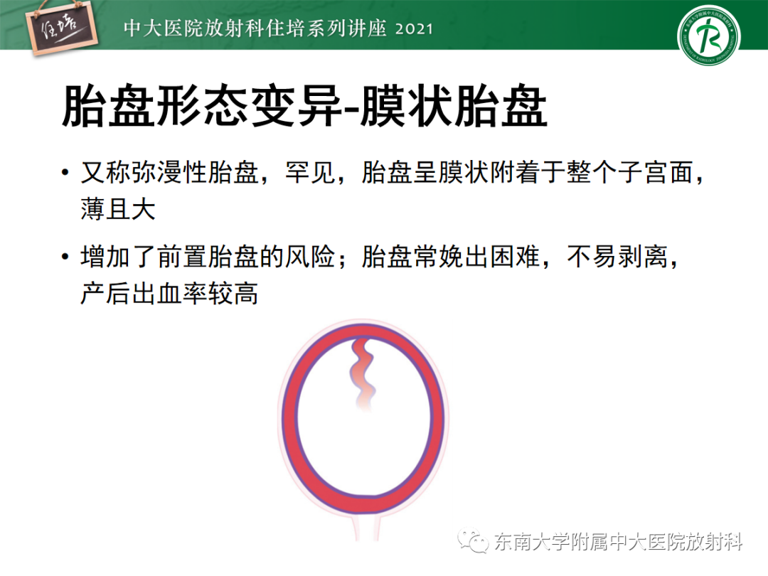 影像PPT - 【PPT】胎盘变异与胎盘植入性疾病的MR评估-14