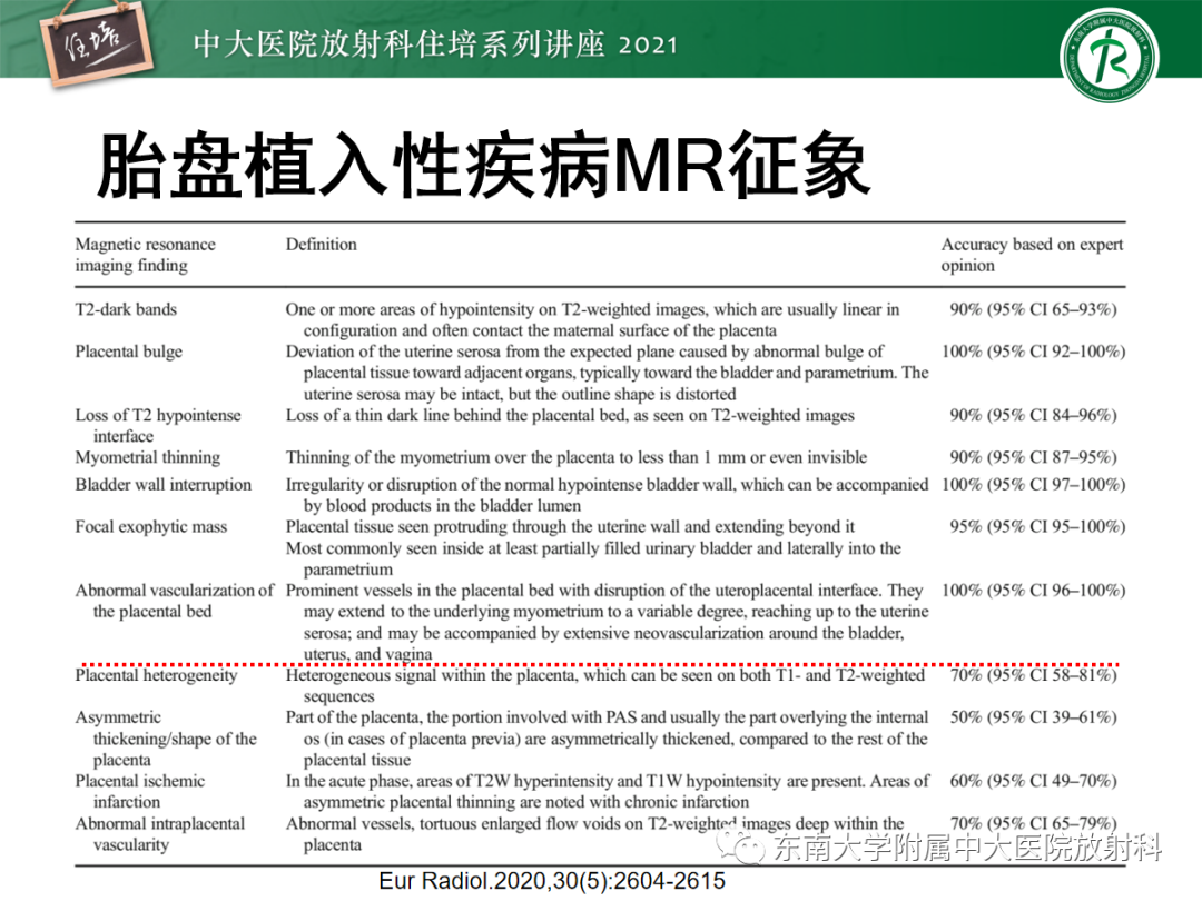影像PPT - 【PPT】胎盘变异与胎盘植入性疾病的MR评估-21