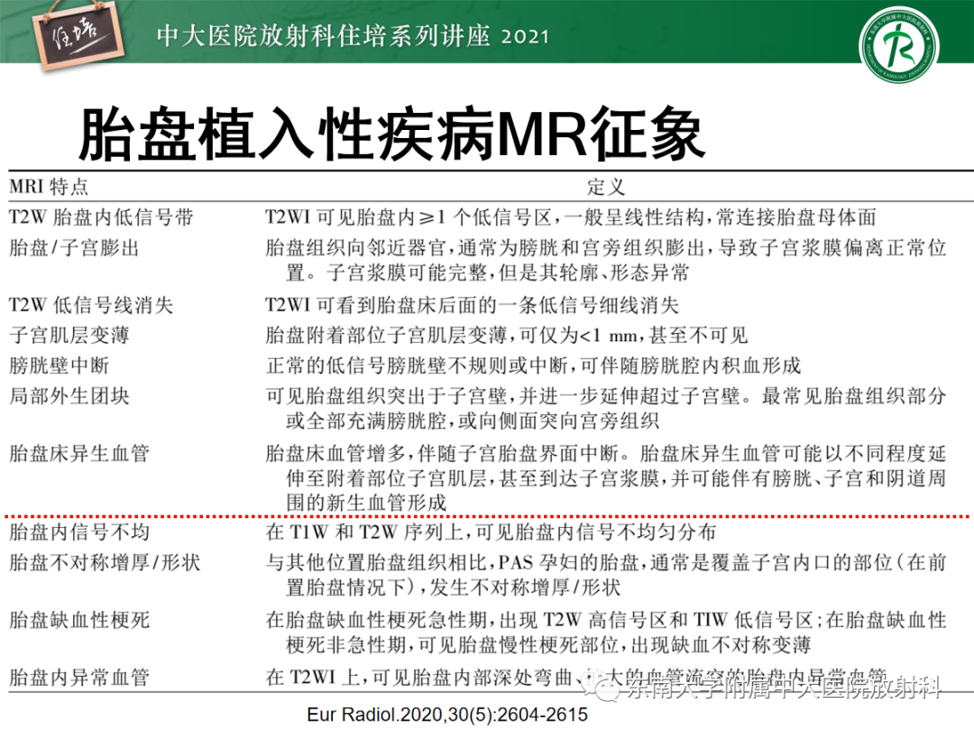 影像PPT - 【PPT】胎盘变异与胎盘植入性疾病的MR评估-22