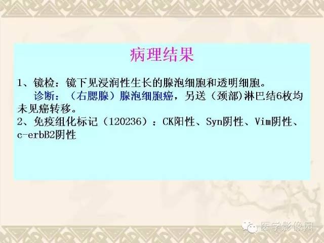 影像PPT - 【病例】腮腺腺泡细胞癌1例CT影像-14