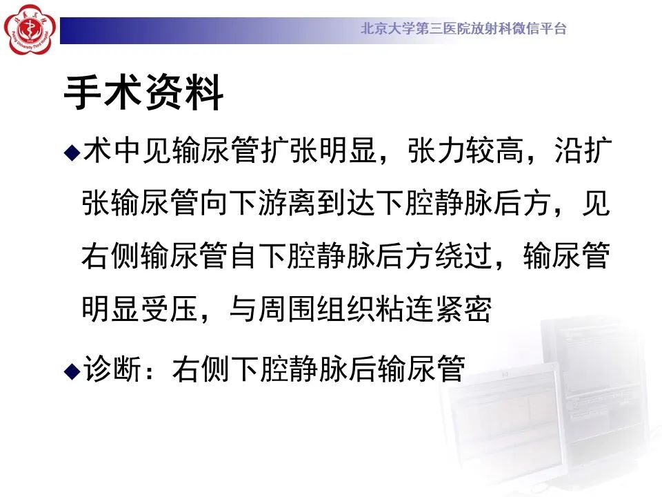 影像PPT - 【PPT】下腔静脉后输尿管的影像-8