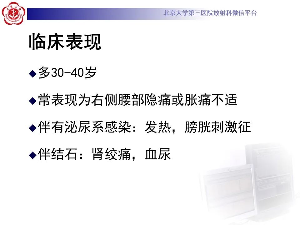 影像PPT - 【PPT】下腔静脉后输尿管的影像-12