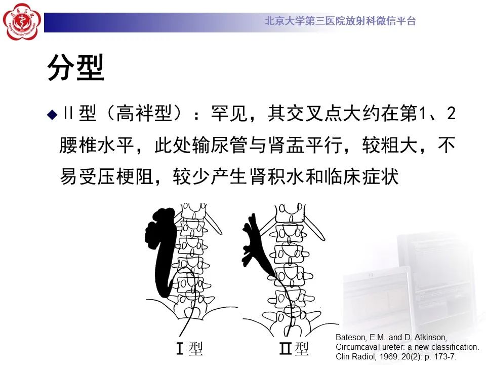 影像PPT - 【PPT】下腔静脉后输尿管的影像-14