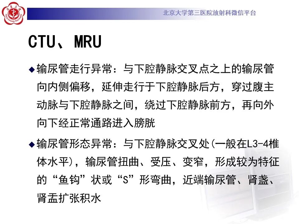 影像PPT - 【PPT】下腔静脉后输尿管的影像-18