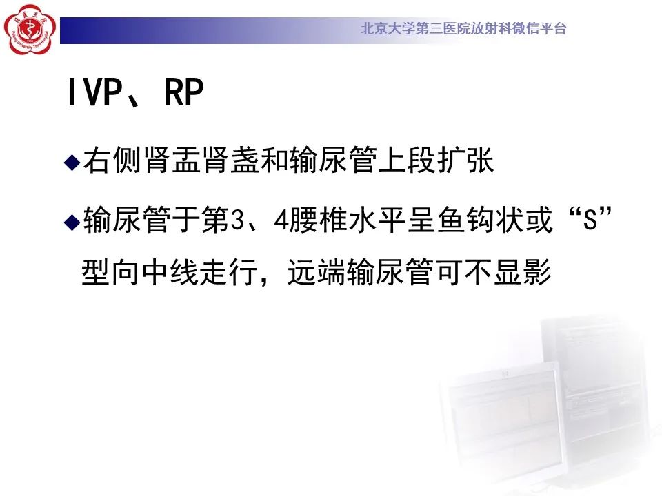 影像PPT - 【PPT】下腔静脉后输尿管的影像-16