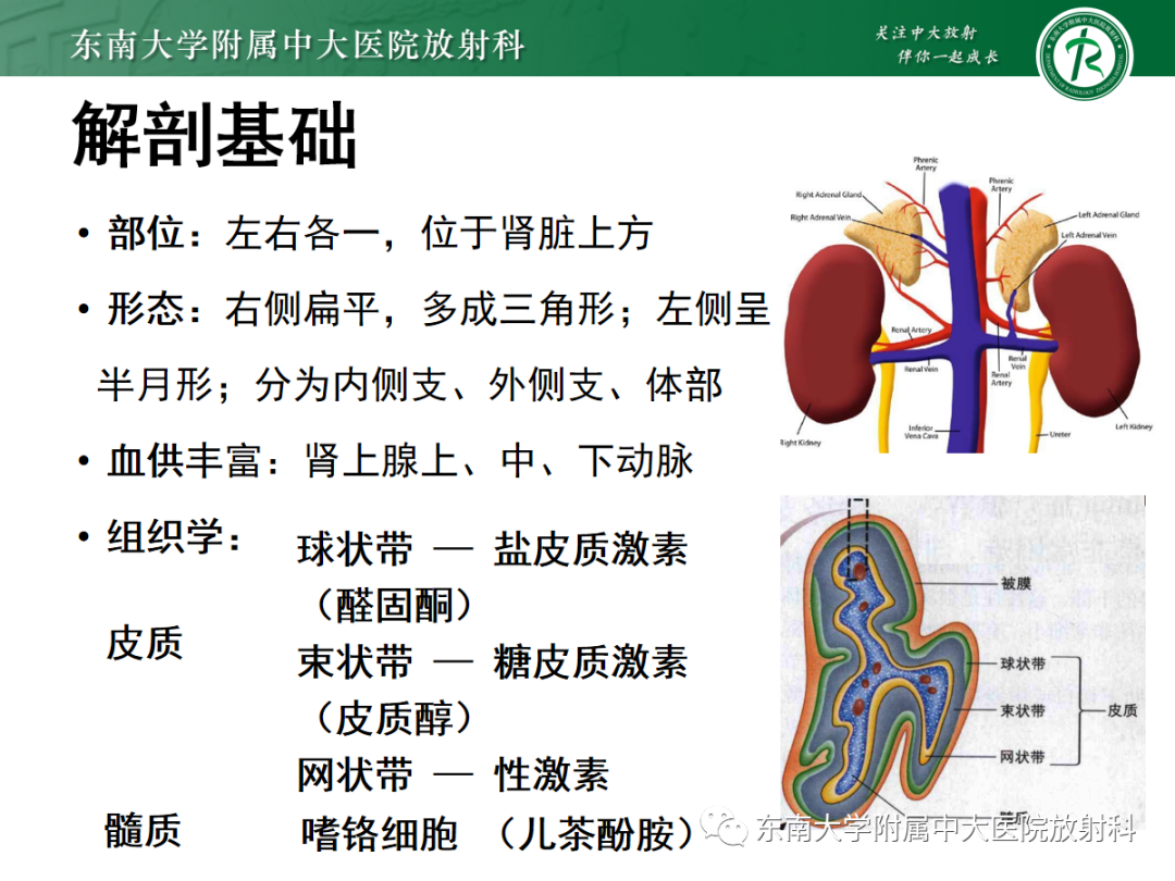 影像PPT - 【PPT】肾上腺占位性病变-4