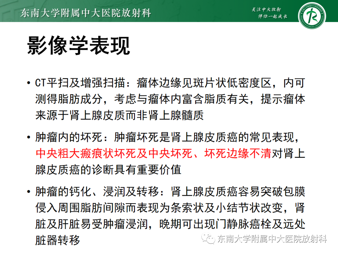 影像PPT - 【PPT】肾上腺占位性病变-16