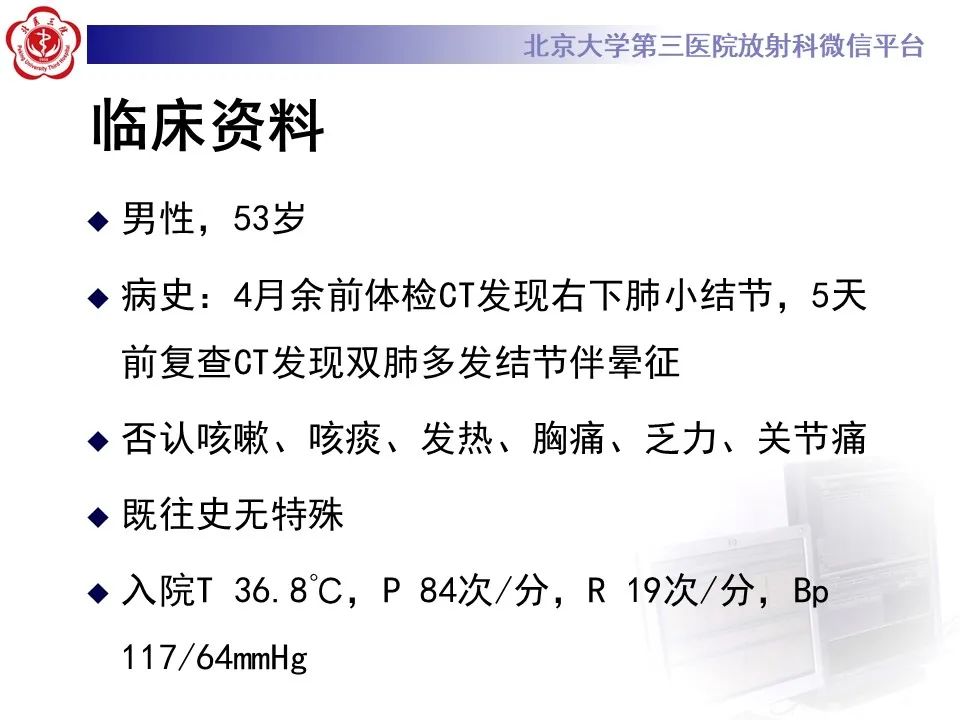影像PPT - 【PPT】肺隐球菌病的影像-3
