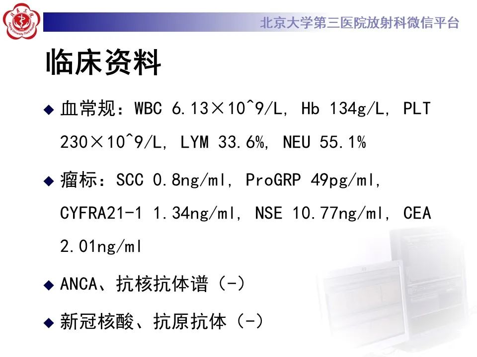 影像PPT - 【PPT】肺隐球菌病的影像-4