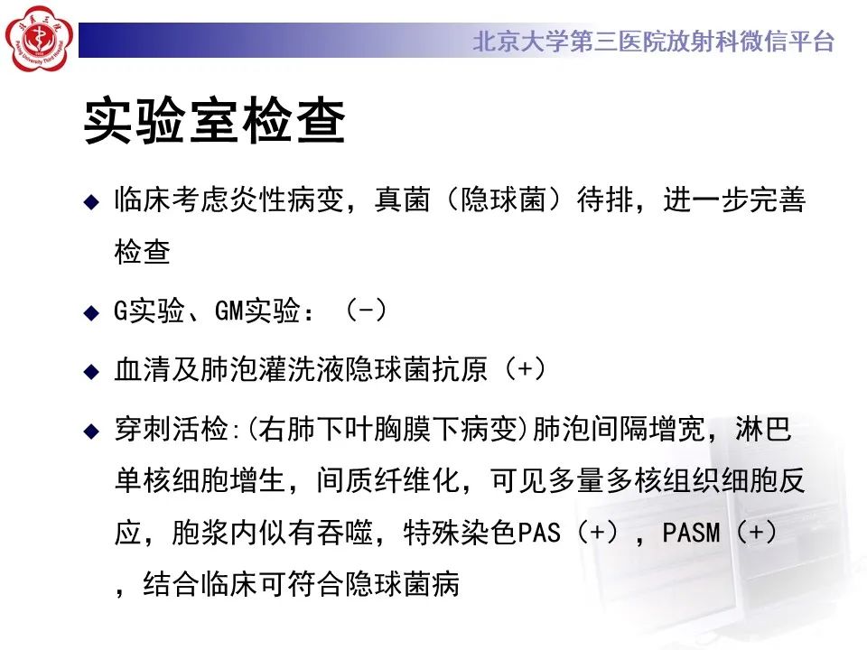 影像PPT - 【PPT】肺隐球菌病的影像-10