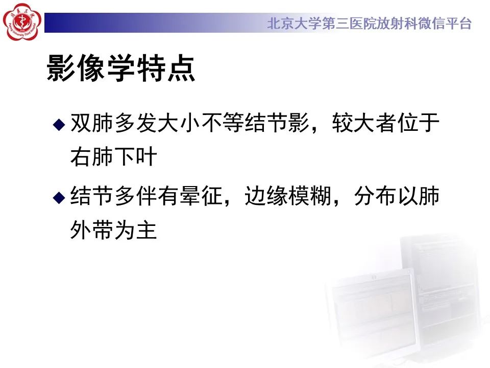 影像PPT - 【PPT】肺隐球菌病的影像-8