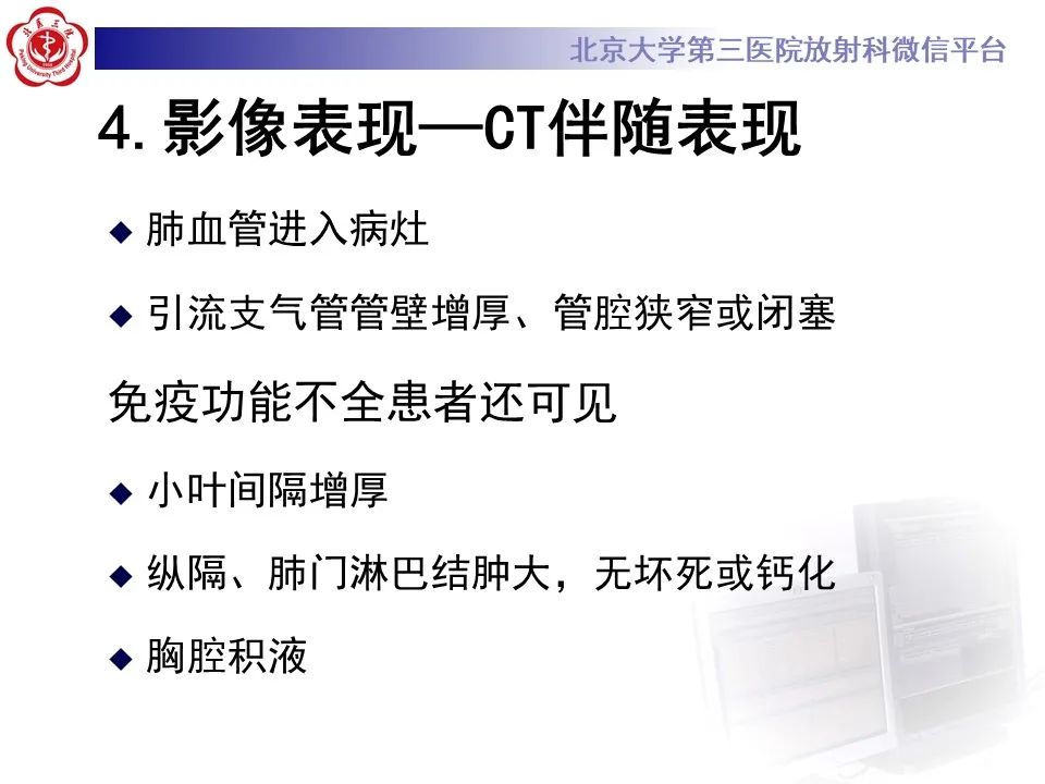 影像PPT - 【PPT】肺隐球菌病的影像-28