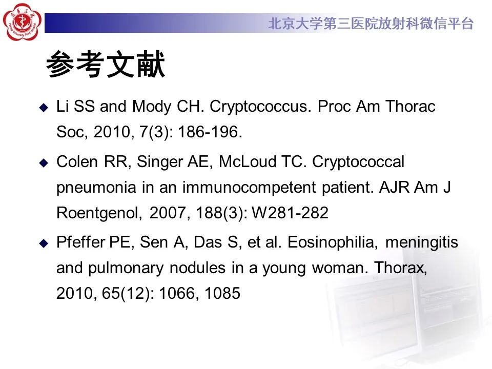 影像PPT - 【PPT】肺隐球菌病的影像-34