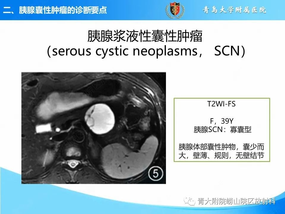 影像PPT - 【PPT】胰腺囊性肿瘤的影像诊断思路-12