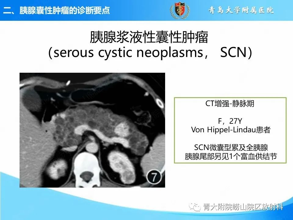 影像PPT - 【PPT】胰腺囊性肿瘤的影像诊断思路-14