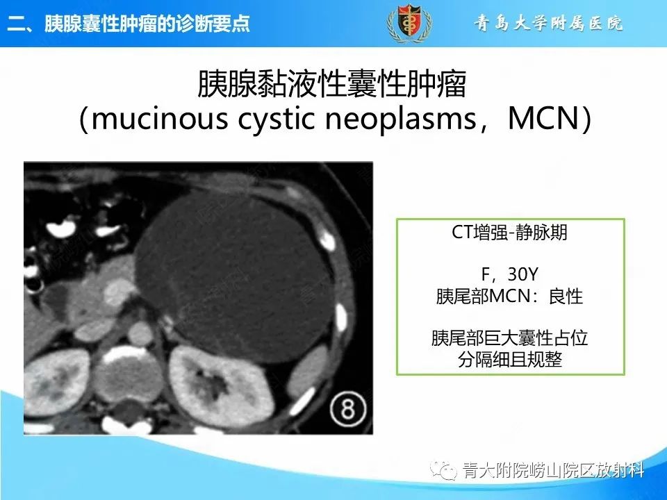 影像PPT - 【PPT】胰腺囊性肿瘤的影像诊断思路-19