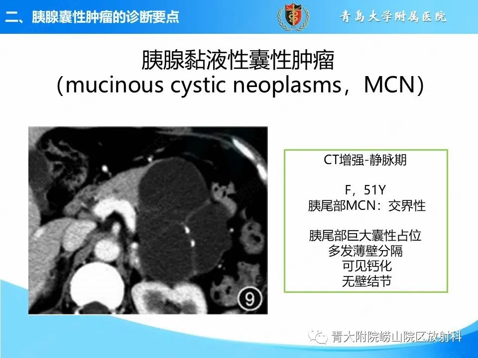 影像PPT - 【PPT】胰腺囊性肿瘤的影像诊断思路-20
