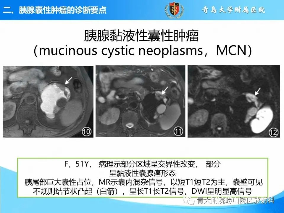 影像PPT - 【PPT】胰腺囊性肿瘤的影像诊断思路-21