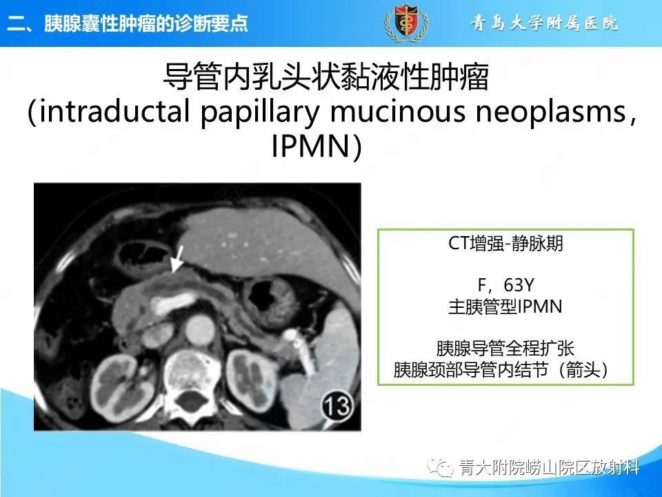 影像PPT - 【PPT】胰腺囊性肿瘤的影像诊断思路-25