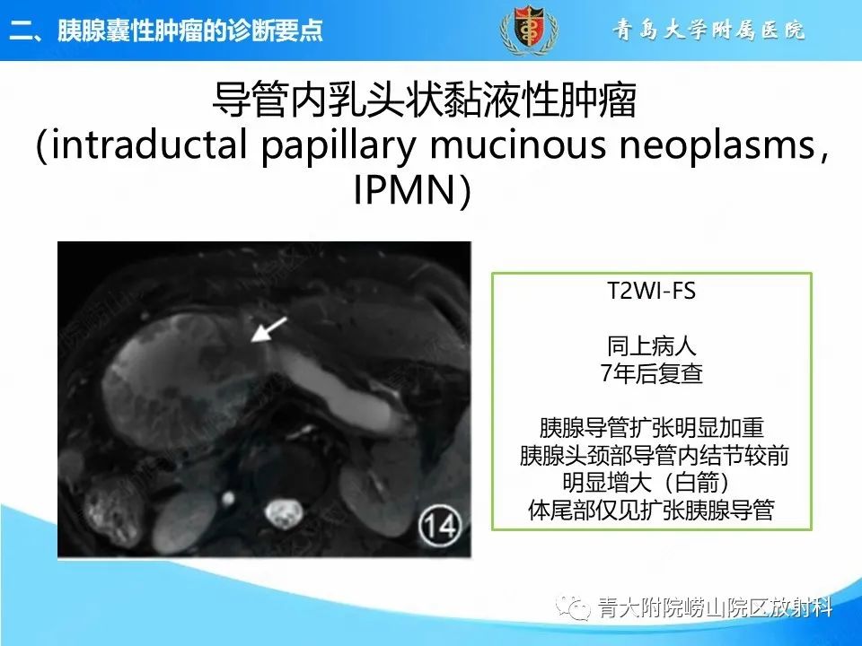 影像PPT - 【PPT】胰腺囊性肿瘤的影像诊断思路-26
