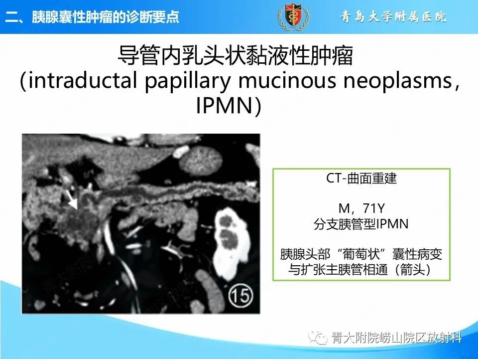 影像PPT - 【PPT】胰腺囊性肿瘤的影像诊断思路-27