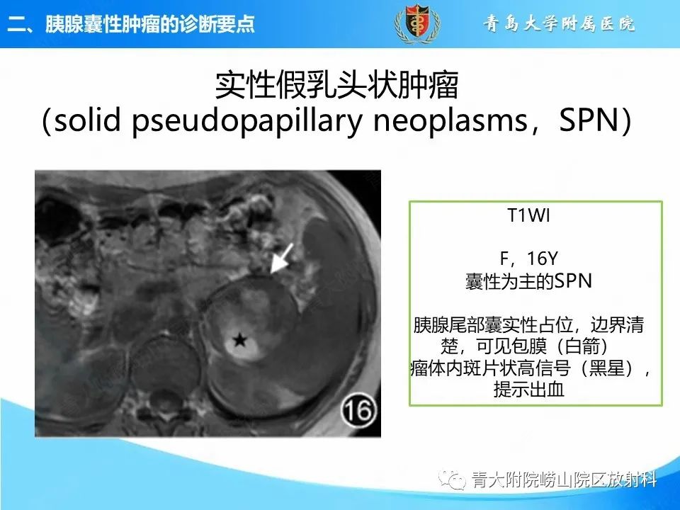 影像PPT - 【PPT】胰腺囊性肿瘤的影像诊断思路-31