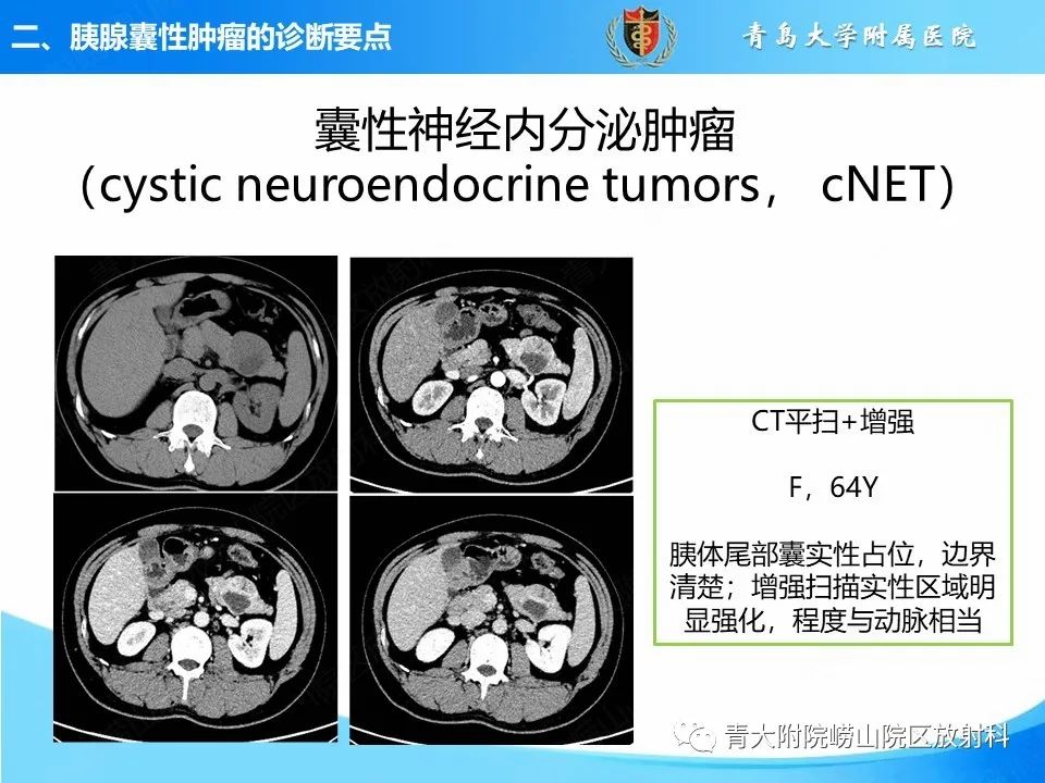 影像PPT - 【PPT】胰腺囊性肿瘤的影像诊断思路-36