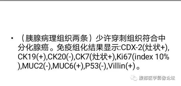 影像PPT - 【病例】胰头癌1例CT及MR-5
