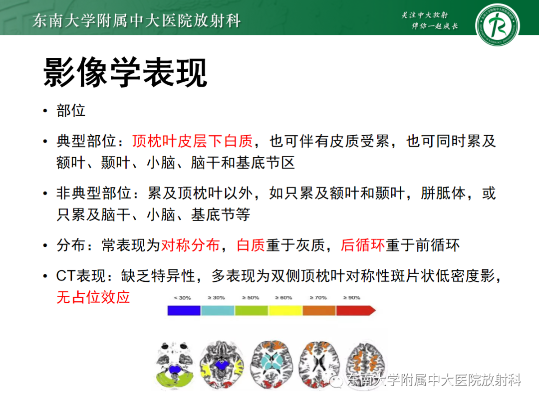 影像PPT - 【PPT】可逆性后部脑病综合征(PRES)1例-12 影像PPT - 【PPT】可逆性后部脑病综合征(PRES)1例-12