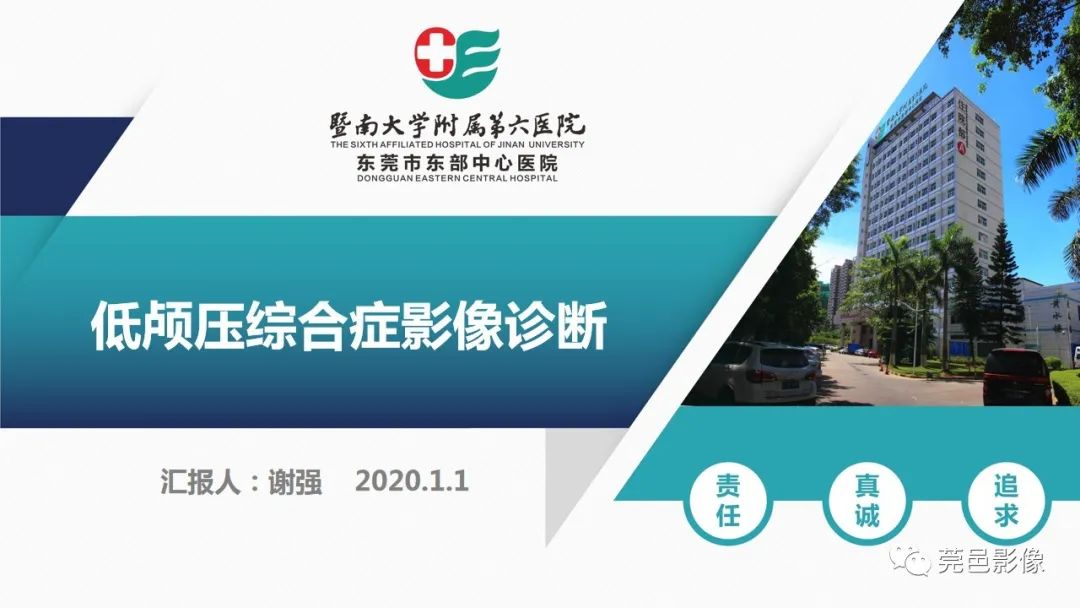 影像PPT - 【PPT】低颅压综合症影像诊断-1