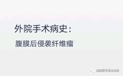 影像PPT - 【病例】腹膜后侵袭性纤维瘤1例CT-4